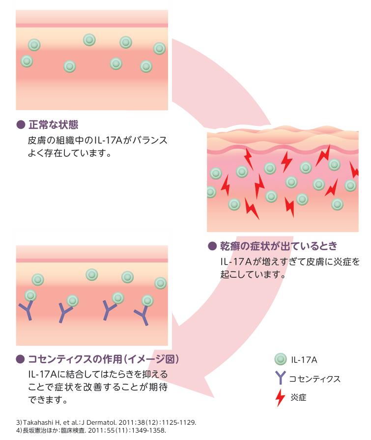 コセンティクス®とは