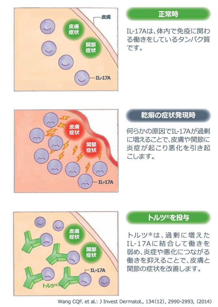 トルツ®とは